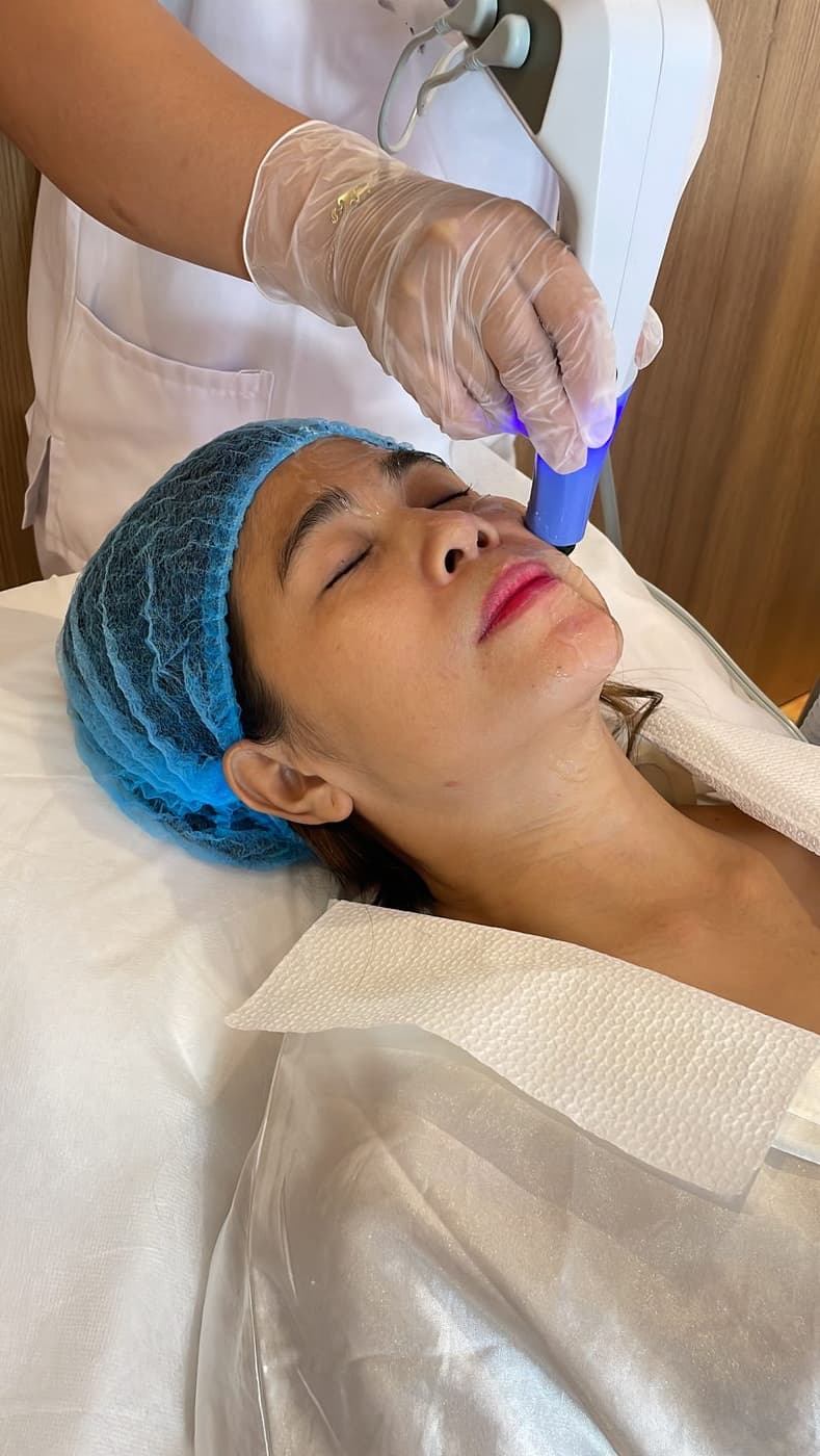 Non-surgical face slimming and contouring options at SOI Clinic