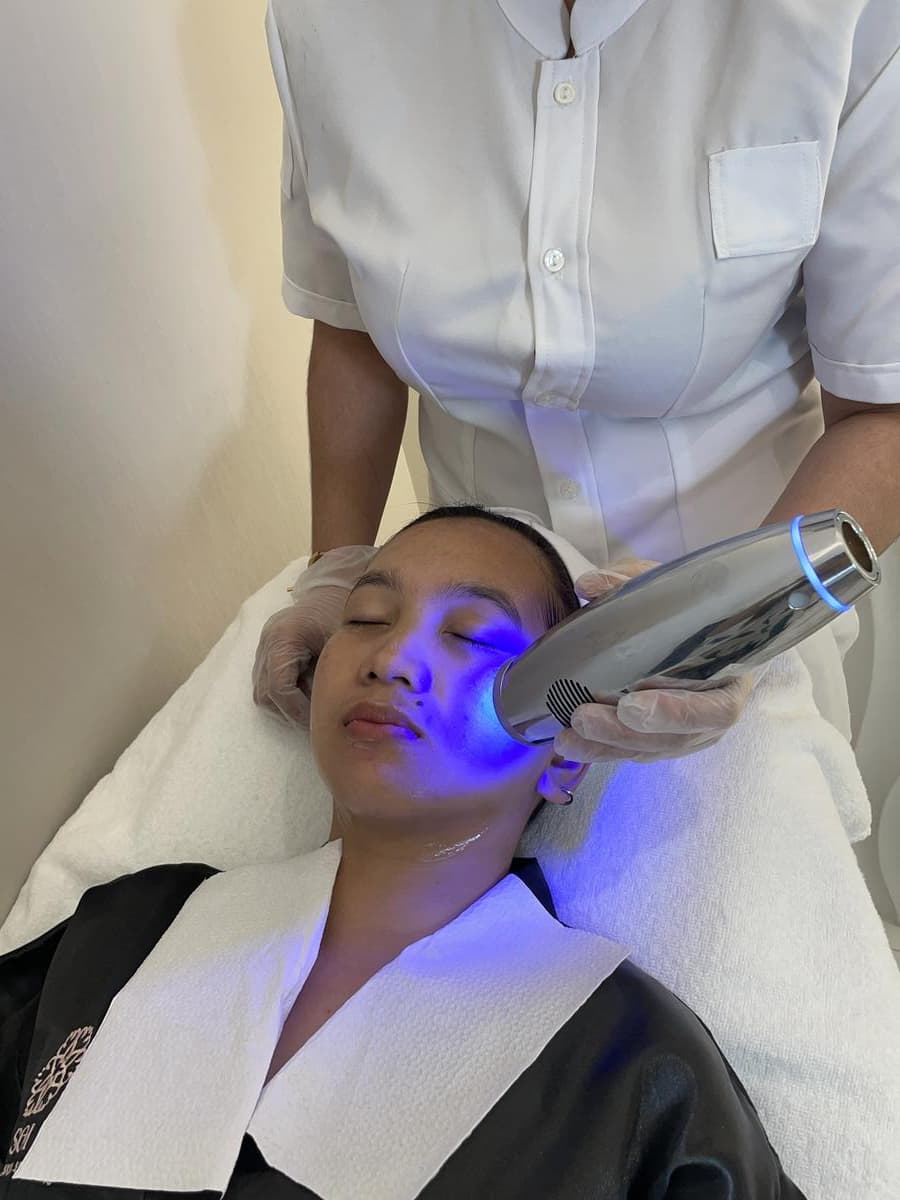 Melasma reduction treatment for dark patches at SOI Clinic