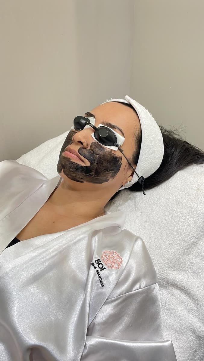 Skin-brightening treatment for hyperpigmentation in morena skin at SOI Clinic
